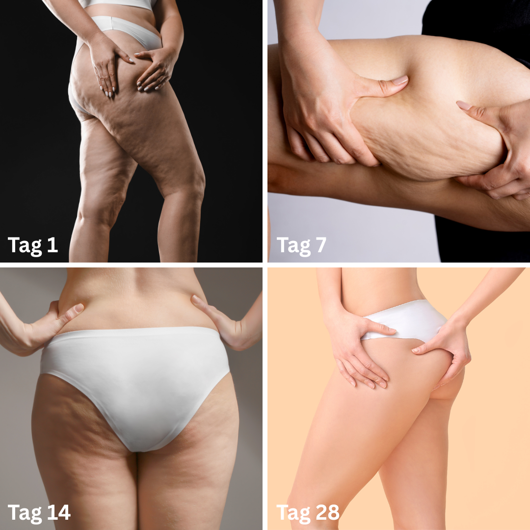 Contoura™ - Massagegerät